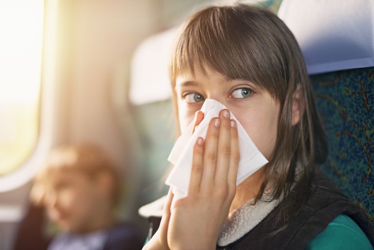 REAÇÕES ALÉRGICAS PODEM SER DESENCADEADAS EM VIAGEM DE AVIÃO