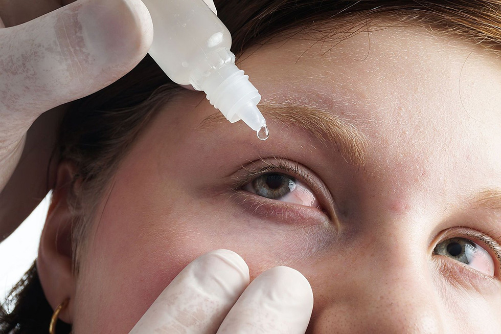 ALERGIA OCULAR PODE SER CONFUNDIDA COM CONJUNTIVITE INFECCIOSA